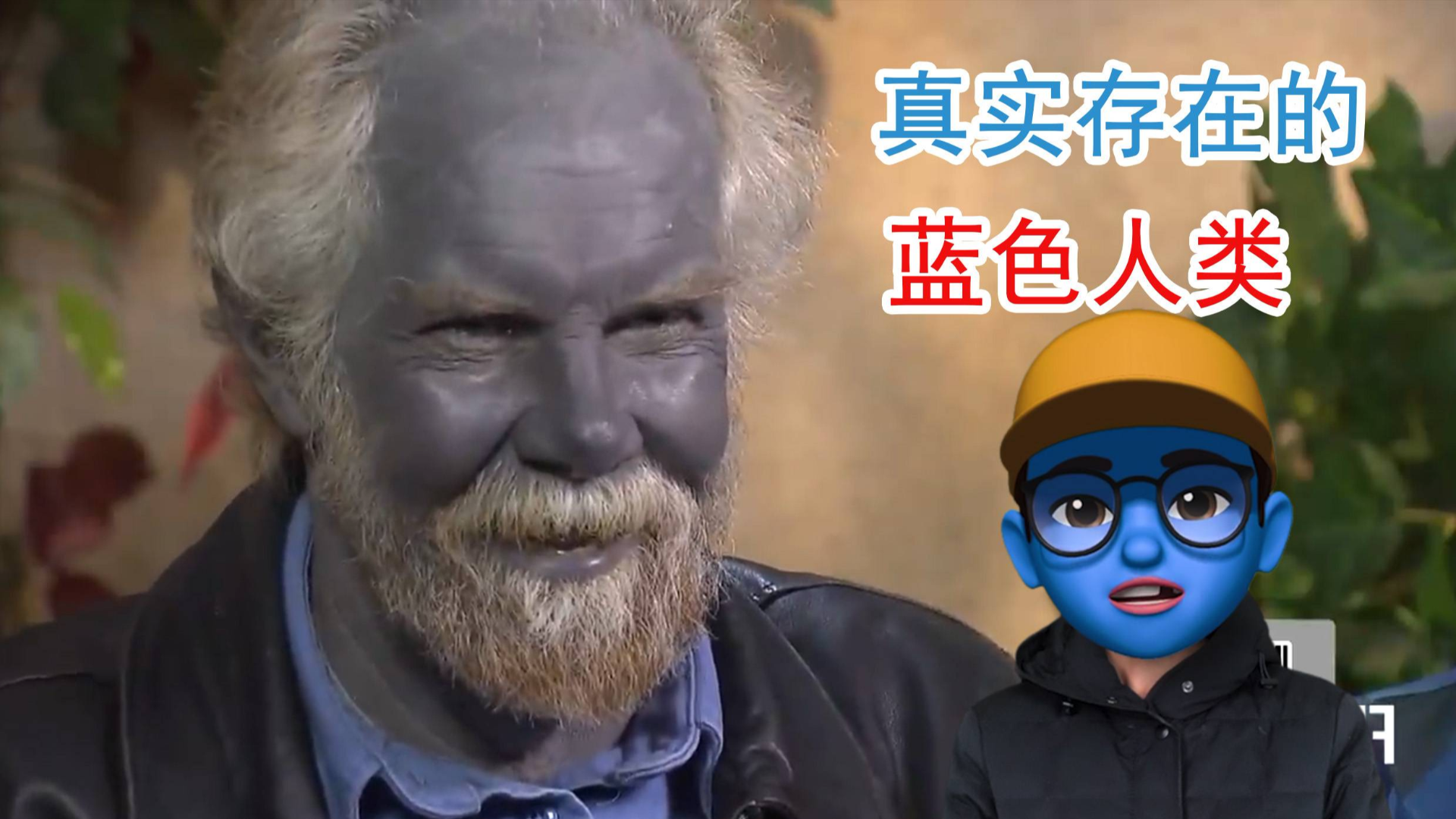真实存在的蓝色人,蓝朋友